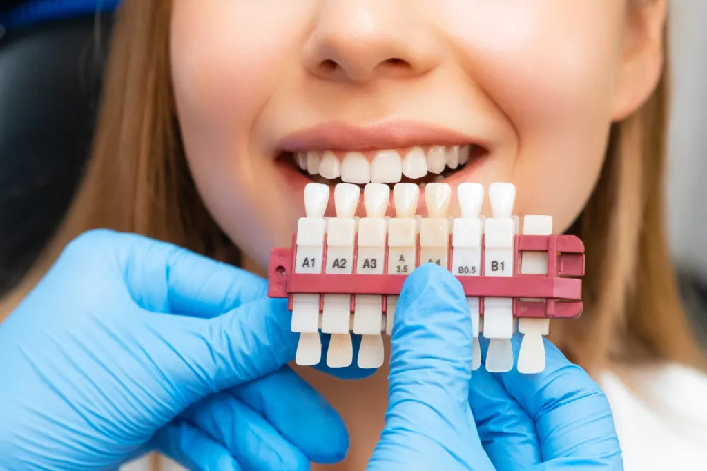 Teeth Whitening: Myths vs Facts Debunked