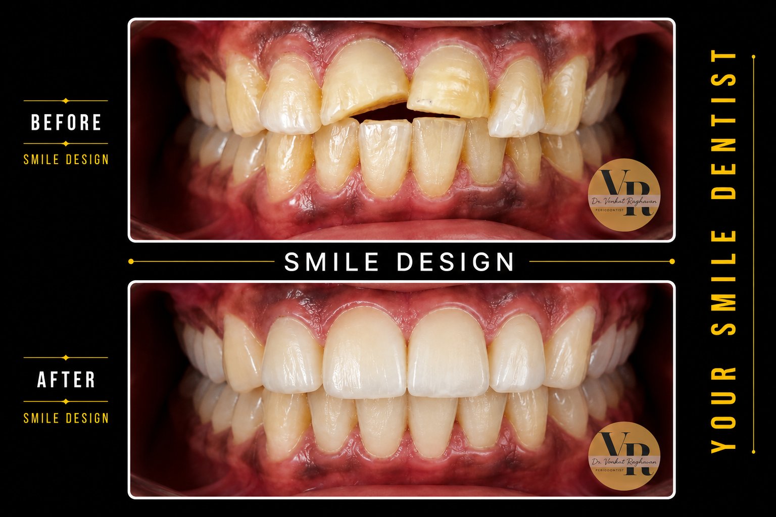 Cosmetic Dentistry